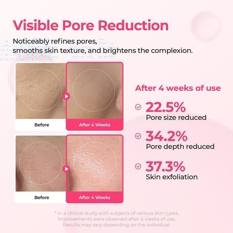 Intensive Discoloration Serum